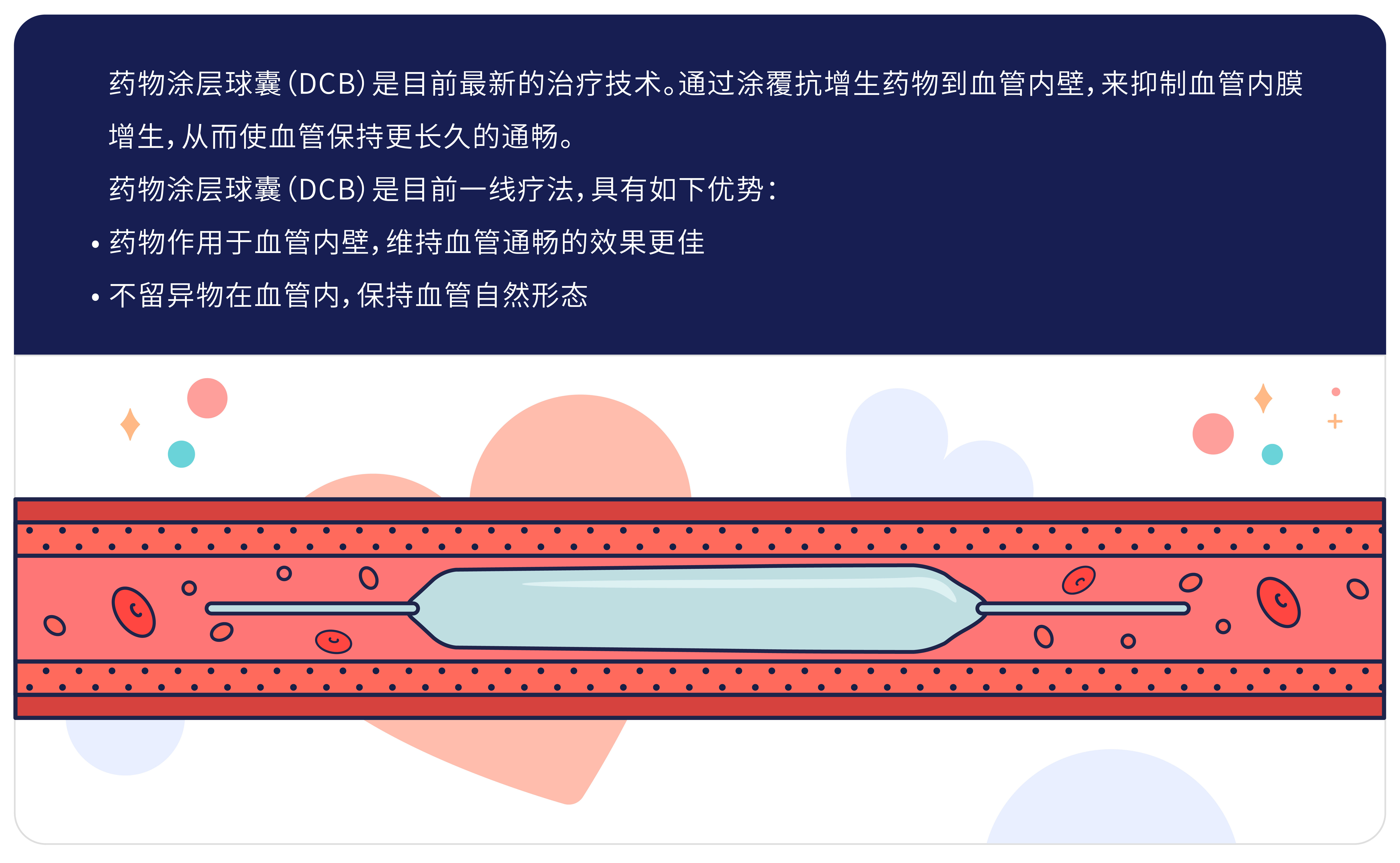 DCB疗法.jpg